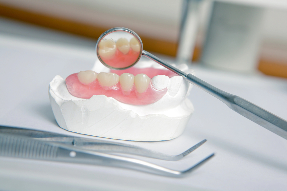 Flexible Partial Denture
